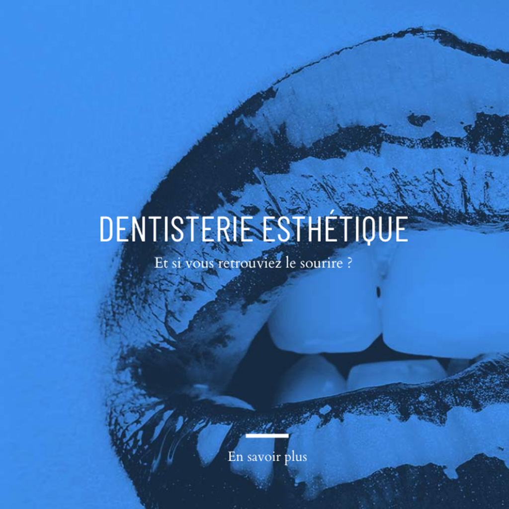 La dentisterie esthétique au cabinet dentaire du Dr Claire CASTETS à Plaisance-du-Touch - Toulouse